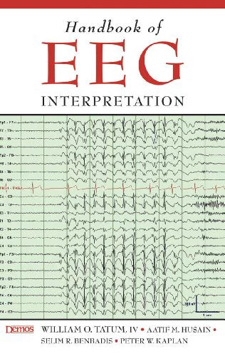 Handbook of EEG Interpretation Paperback N694